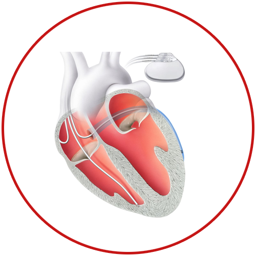 crt-therapy-in-delhi