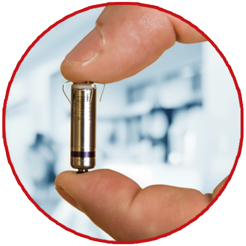 leadless-pacemaker-in-delhi