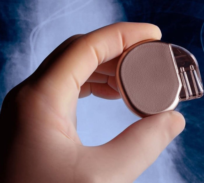 pacemaker doctor in delhi